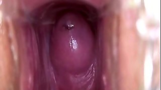 amateur, creampie, medical