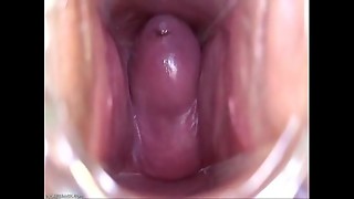 amateur, creampie, medical