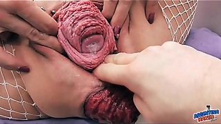 anal, extreme, fisting, gaping, prolapse, pussy