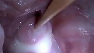 bdsm, creampie, cum, cumshot, gaping, insertion, japanese, medical, pussy, sperm